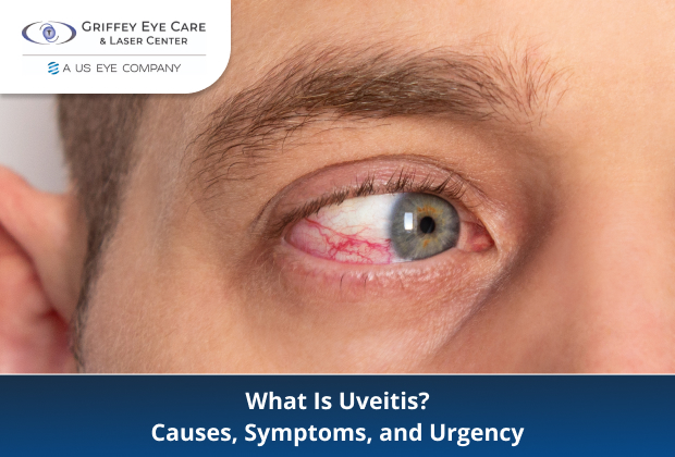 Close-up of red, irritated eye with Griffey Eye Care logo and text: What Is Uveitis? Causes, Symptoms, and Urgency